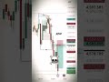 “Before &amp; After Trade 🔥 | Real Precision Trading”