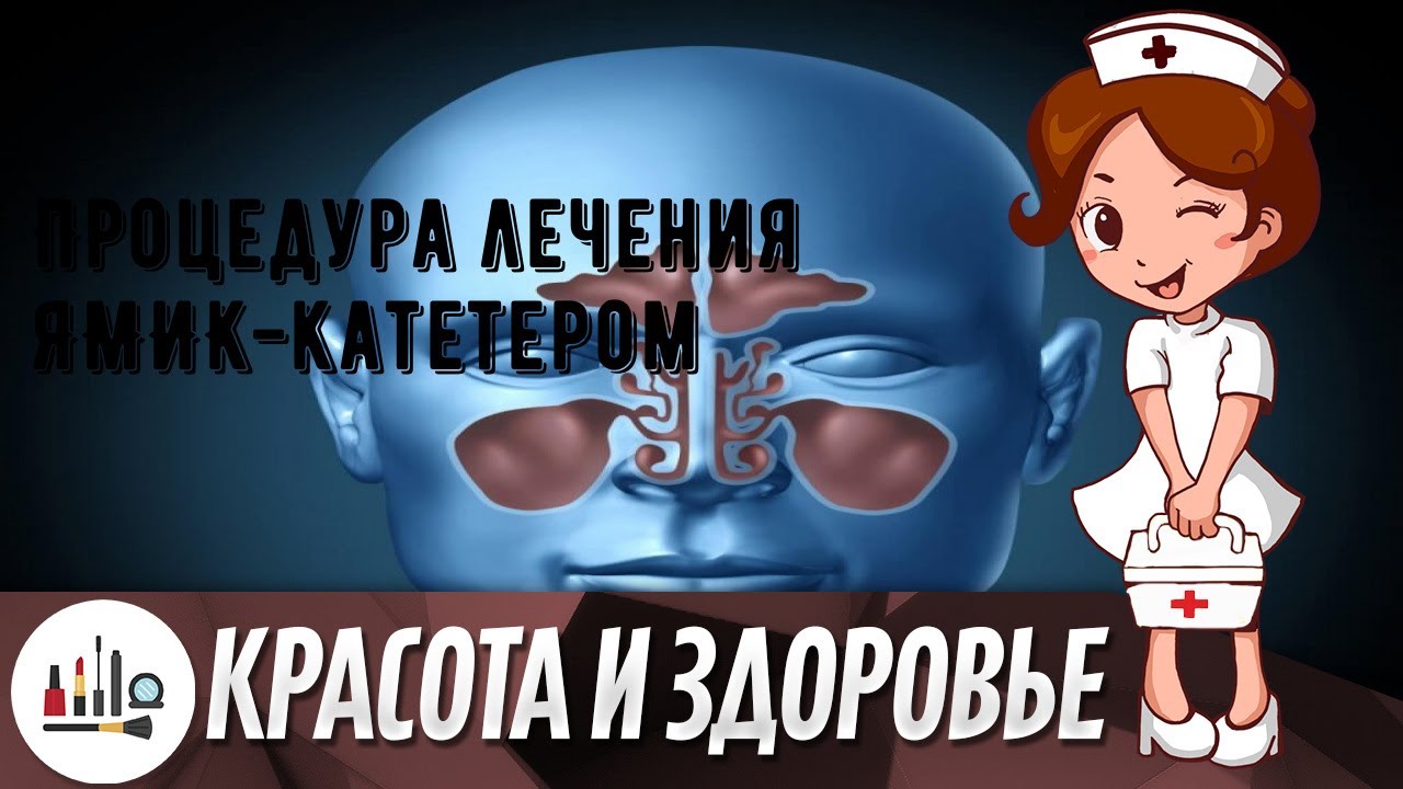 Процедура лечения ЯМИК-катетером - YouTube