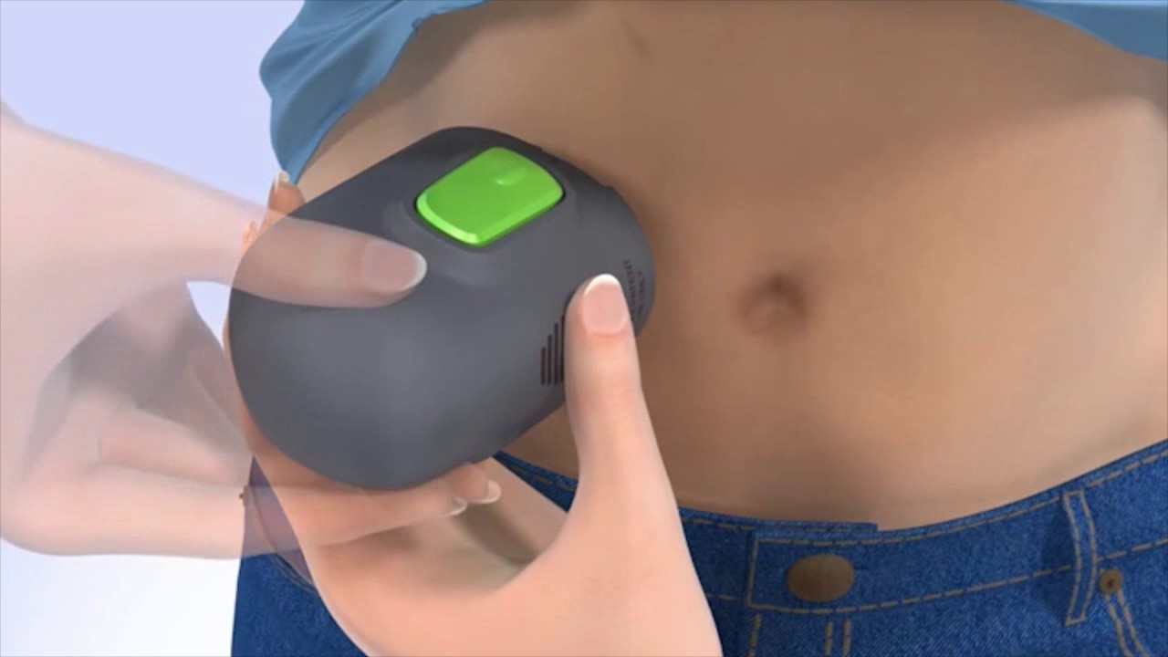 Medtronic Wie Sie Den Sensor Fur Das Cgm System Guardian Connect Anlegen Youtube