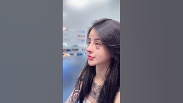 Nâng mũi cấu trúc - Cắt mí sau 10 ngày phẫu thuật #nhatha