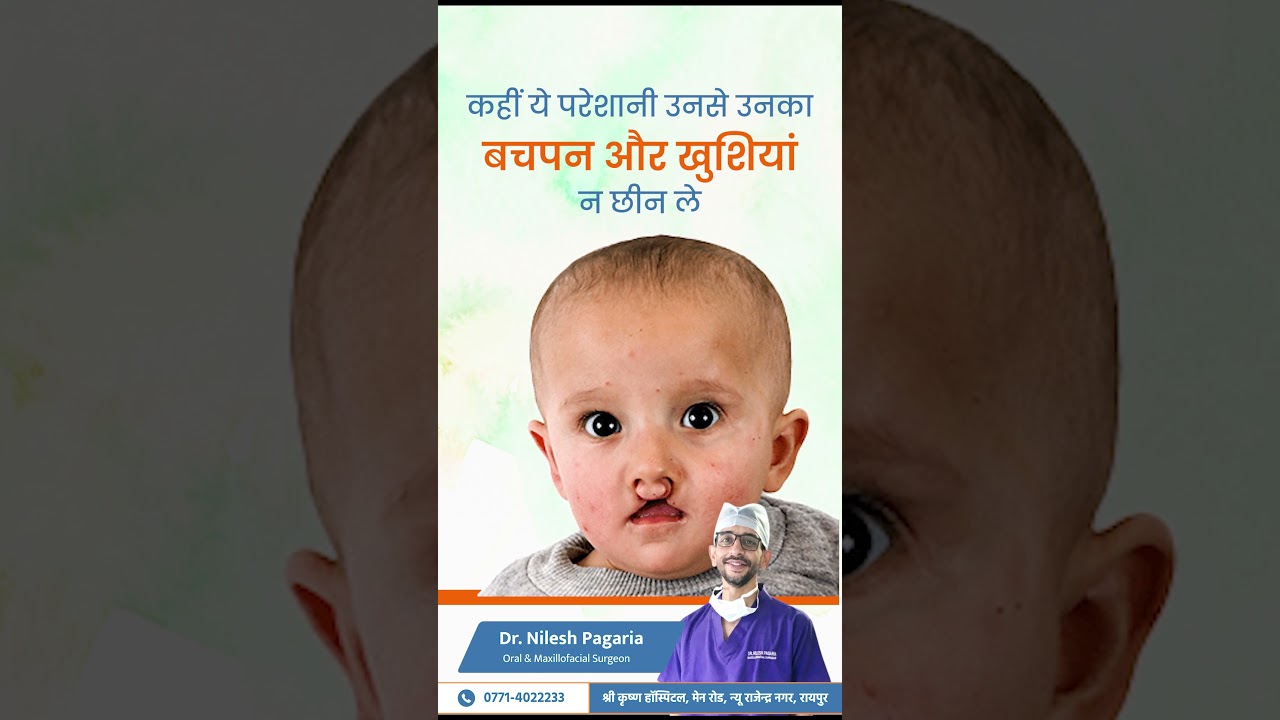 Cleft Lips Problems in Child | Dr. Nilesh Pagaria (Maxillofacial Surgeon)