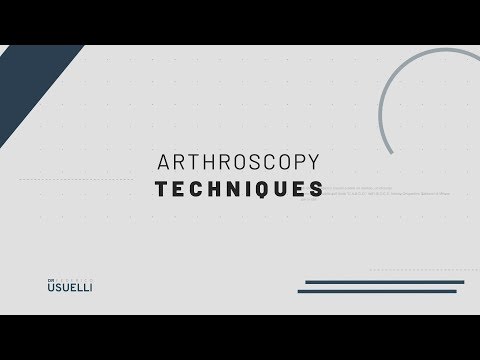 Video: Arthroscopy bersama