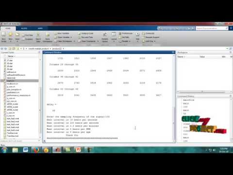 Supraventricular Tachycardia Classification 12-Lead ECG Using | Final Year Projects 2016 - 2017