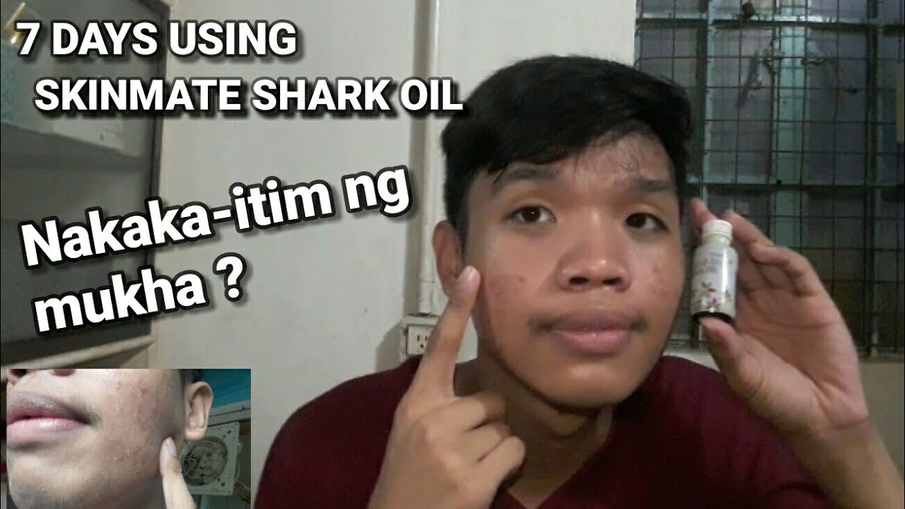 7 DAYS USING SKIN MATE SHARK OIL | LUCKY KNICK