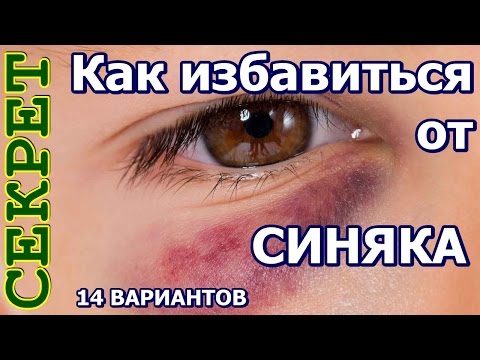 Video: Сүрөттөгү кемчиликтерди кантип кетирсе болот