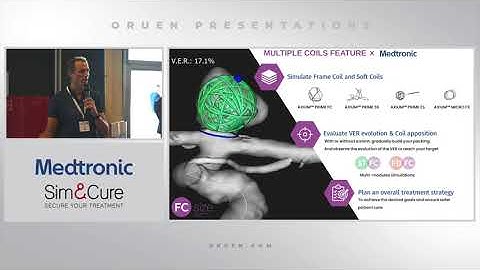 Prof. Vincent Costalat talking about coiling procedures at ESMINT 2022 - Medtronic x Sim&Cure