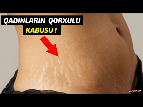 Video: Çatlaqlar üçün bitki ideyaları - Çatlarda və yarıqlarda bağçılıq üçün məsləhətlər