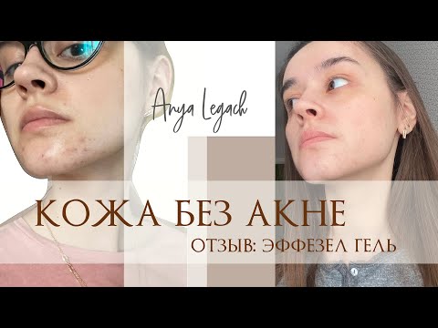 ЭФФЕЗЕЛ: крем ОТ АКНЕ | ОПЫТ ИСПОЛЬЗОВАНИЯ | ДО и ПОСЛЕ ФОТО