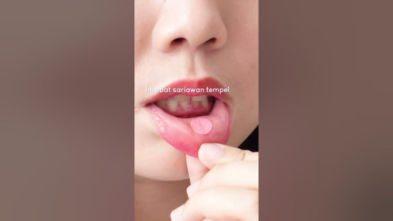 Jangan pake ini kalo ga sariawan 😅