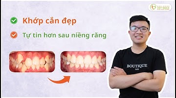 Tháo niềng răng hô, khấp khểnh - Khuôn mặt cân đối, tự tin hơn - KH.Phan Văn Thi