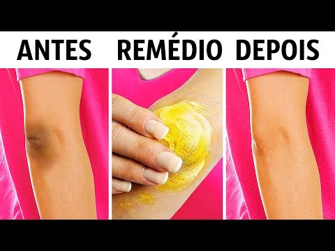 Vídeo: Como Remover Seus Joelhos