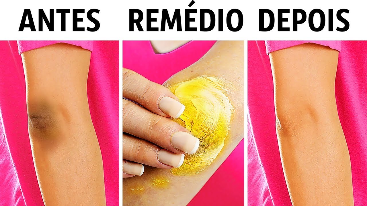 10 Truques Naturais Para Clarear Os Joelhos e Cotovelos - YouTube