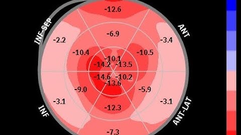 Chuẩn hóa siêu âm tim theo các khuyến cáo hiện hành: Phần trình diễn siêu âm tim qua thành ngực