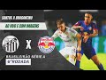 🔴SANTOS X BRAGANTINO AO VIVO COM IMAGENS (BRASILEIRÃO SÉRIE A 2025)