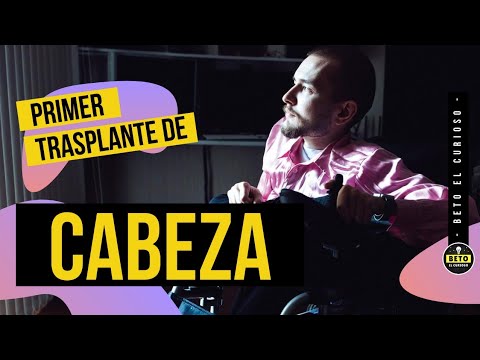 Vídeo: Sergio Canavero Anunció Su Casi Completa Disposición Para Un Trasplante De Cabeza - Vista Alternativa