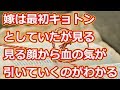 僕の子かどうかわからないからね