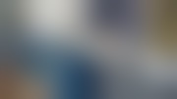 Tibial Case with StimRouter - Real Case