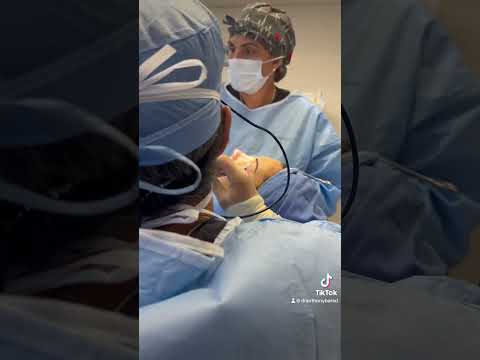 Video thumbnail: Ultrasonic rhinoplasty- behind the scenes | Anthony Bared MD, FACS | Miami, FL · Dr. Anthony Bared, M.D - Facial Plastic Surgeon