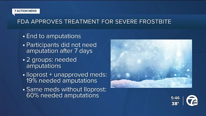 First medication to treat severe frostbite approved by FDA: Here's what to know