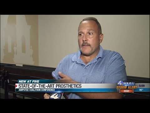 Veteran uses state-of-the-art prosthetic technology