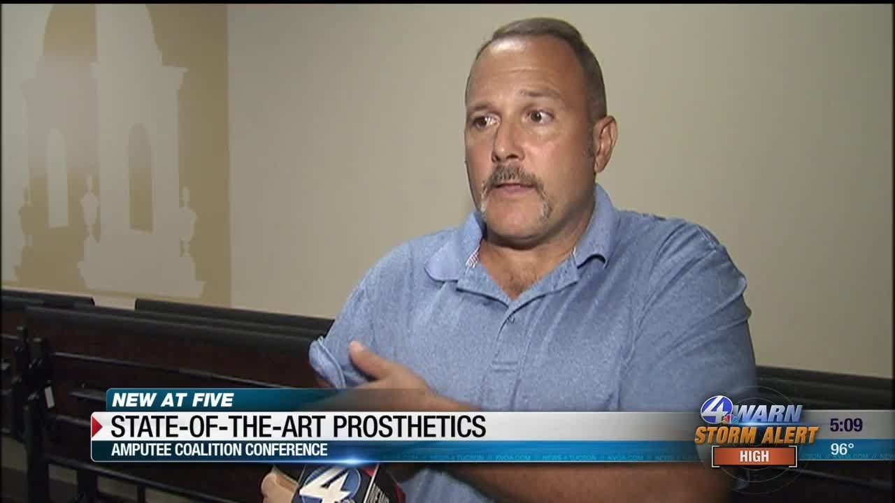 Veteran uses state-of-the-art prosthetic technology