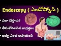 Endoscopy Test  in Telugu|ఎండోస్కోపి ఎలా చేస్తారు, ఖర్చు ఎంత అవుతుంది.