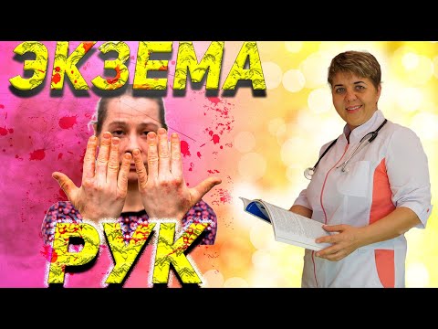 💊 Экзема 🔴 на руках, причины, диагностика, лечение, профилактика.