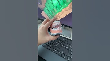 This Is How We Design Smiles Today! #imaginedragons #exocad #shorts