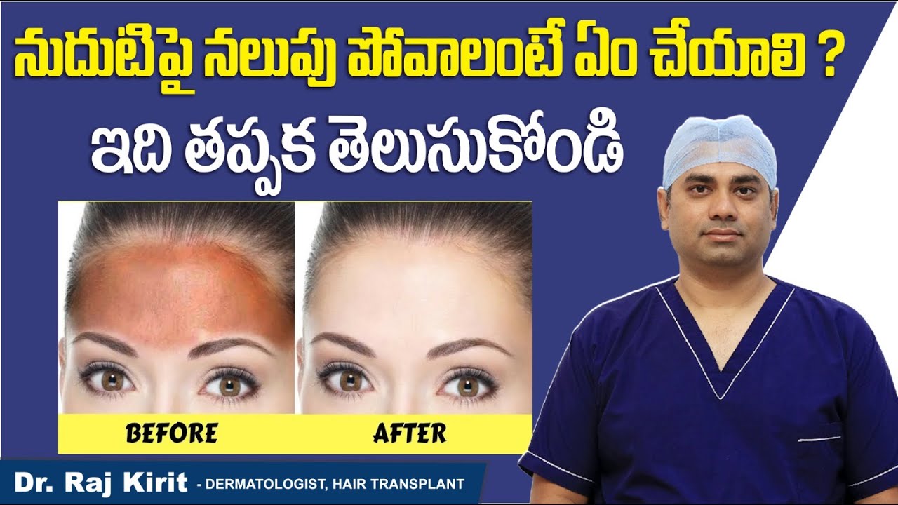 నుదుటిపై నలుపు పోవాలంటే || How To Get Rid Of Forehead Tan In Telugu ...