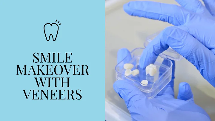 10 Years Younger in 10 Days, Jackie has a smile makeover with veneers