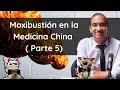 Moxibustión: Desde la teoría clásica a la investigación moderna ( 5 parte)