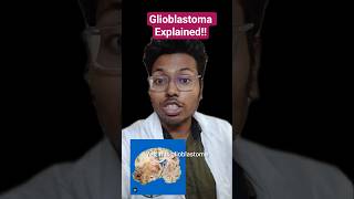 Glioblastoma Explained!! #usmle #plab1 #neetpg #inicet #mbbs #pathology #medicalstudent #shorts