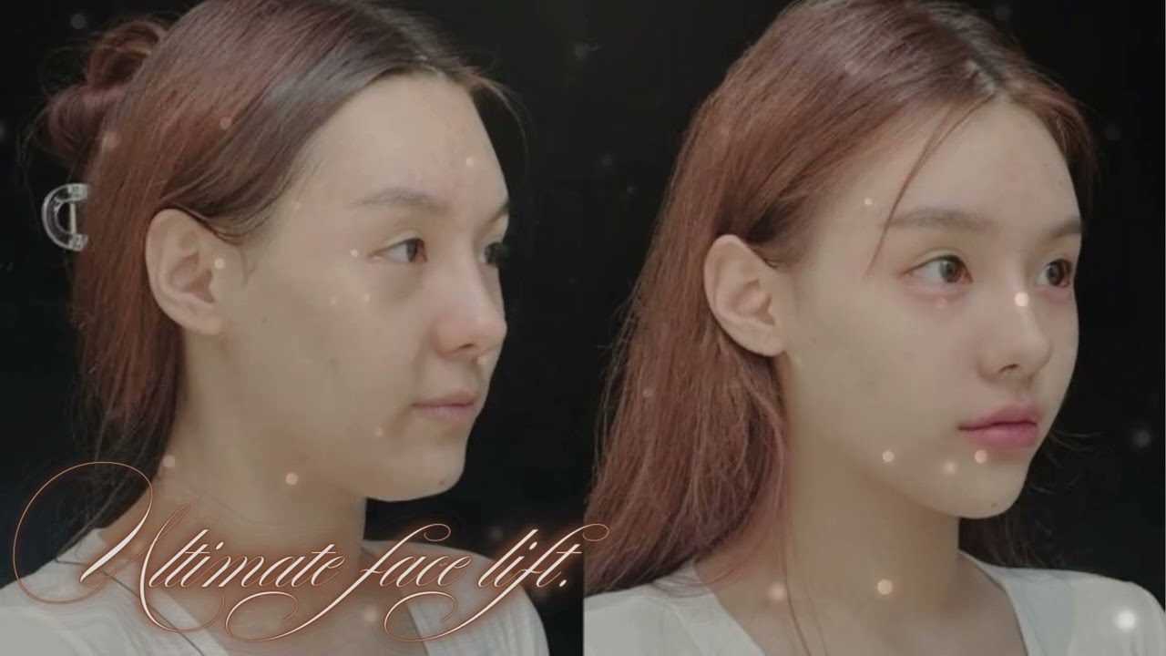 Ultimate Face Lift, Smile Lines Removal, Malar Pad Lift, Lymphatic Drainage Subliminal | lian's reup