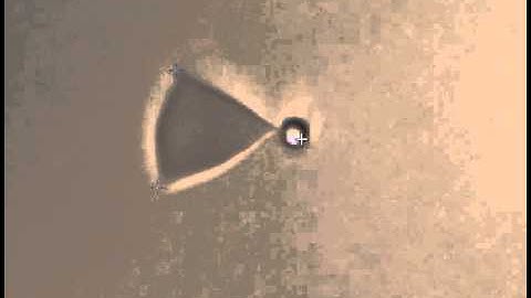 Optical Tweezers - Red Blood Cell and Bead Manipulation