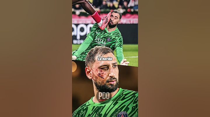 ¡Donnarumma casi pierde un ojo en un partido! 😱👁️