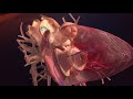 Opration cardiaque en 3d  cathter cardiaque