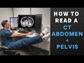 Radiology:  How to Read a CT Abdomen & Pelvis (My search pattern)