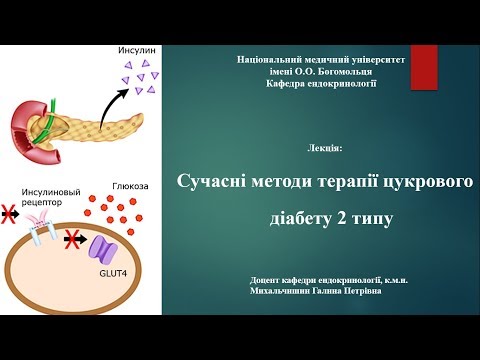 Cучасні методи терапії цукрового діабету 2 типу