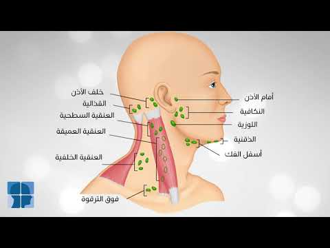 اللمفاوية الغدد علاج الغدد