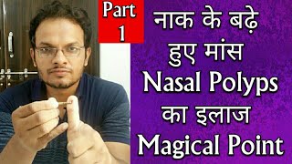 Single Acupressure Point For NASAL POLYPS In Hindi - Just Press This Point to Cure Nasal  Polyps 1