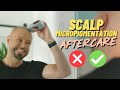 Scalp Micropigmentation AFTERCARE Guidelines