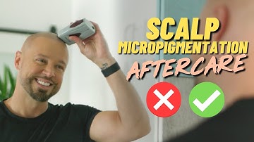 Scalp Micropigmentation AFTERCARE Guidelines