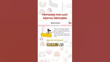 Tripoding For Cast Partial Dentures