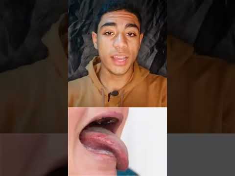 عضه اللسان