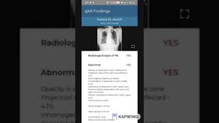 Virtual Innovation Spotlight – qXR App Demo powered by Qure.ai screenshot 2