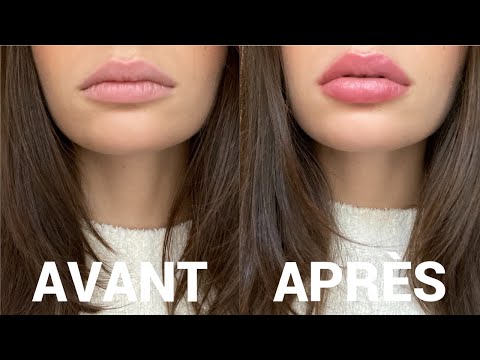 Vidéo: Comment Agrandir Les Lèvres