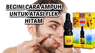 CARA HILANGKAN FLEK HITAM DENGAN AMAN | PROPOLIS DIAMOND LITE