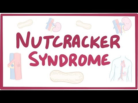 Video: Renal Nutcracker Syndrome: Symptomen, Oorzaken En Behandeling