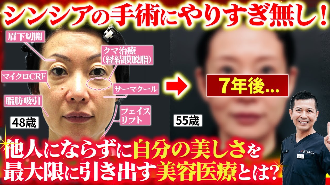 【若返り治療】シンシアに7年間通い続けた55歳女性の変化を大公開！又吉が考える解剖学的に自然な美しさとは？【アンチエイジング】