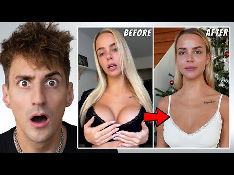 Why My Girlfriend Had to Get Her Breast Implants Removed (-$20,000)